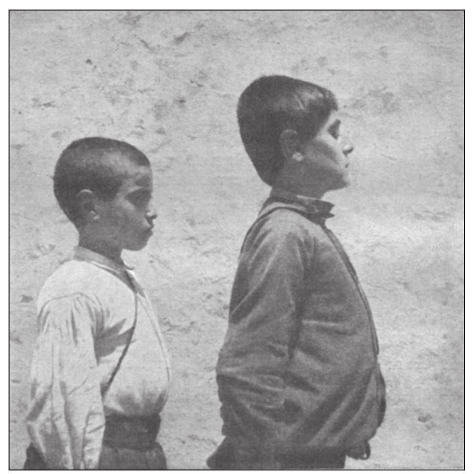 Fig. 1. Modern relics of ancient of Dorian/Aryan  migrations typified by cranial shapes, in Hawes 1909-1910: 271, fig. 2. 