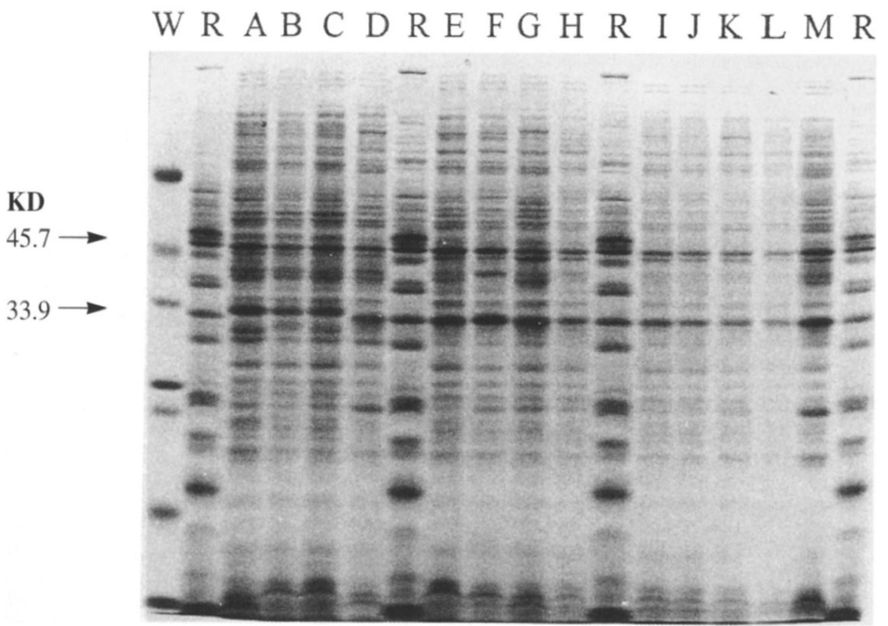 Pattern E4 Sds-page protein electrophoretic patterns of 13 selected