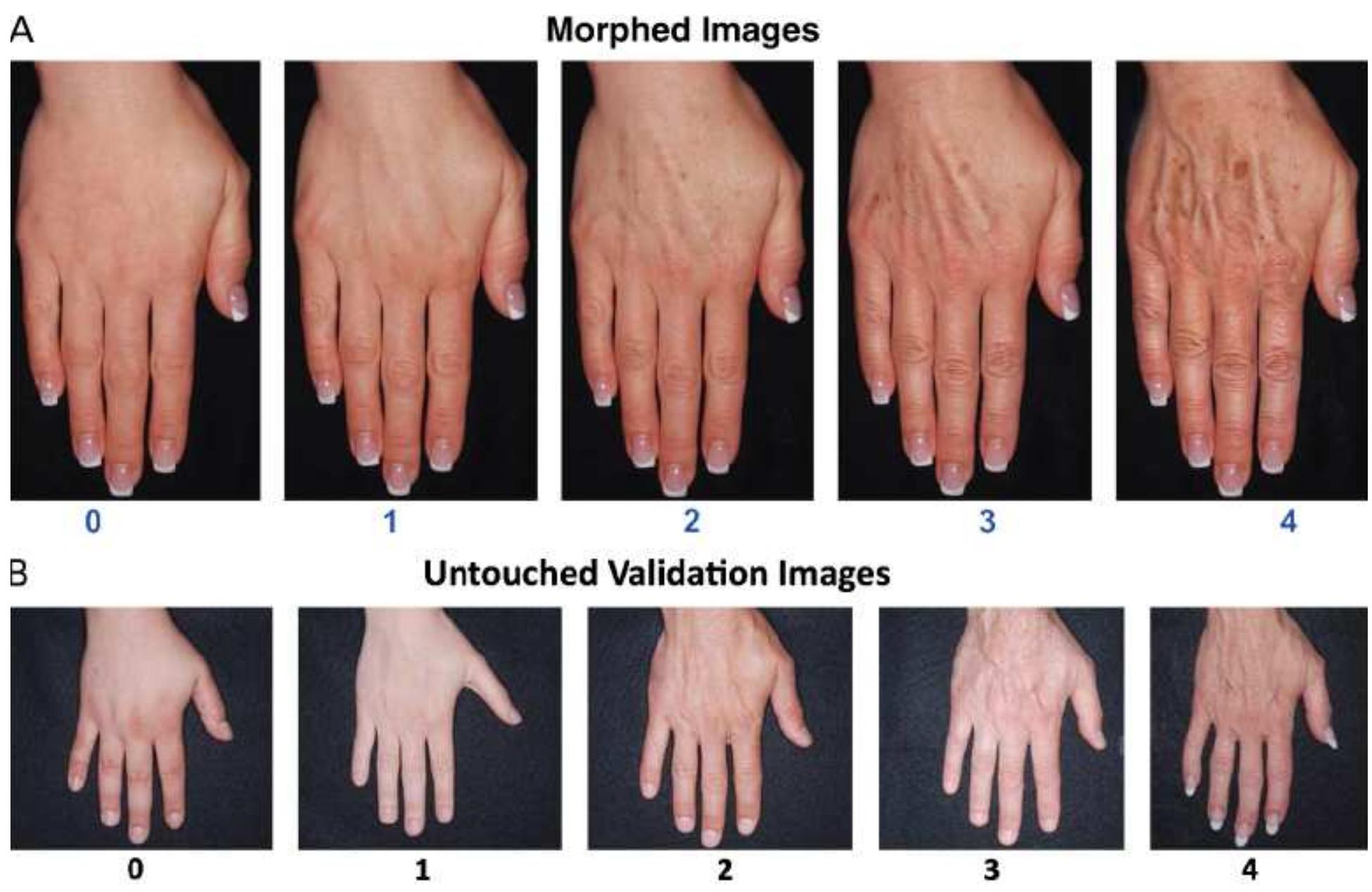 (PDF) A Validated Hand Grading Scale