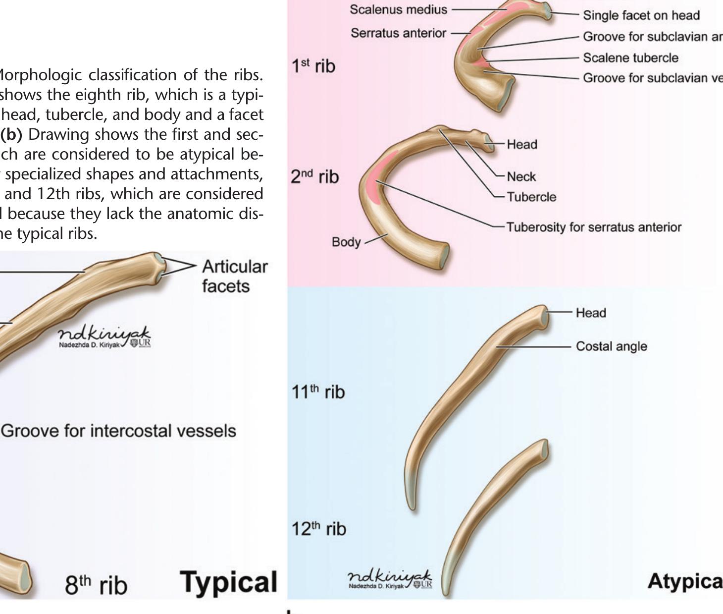 (PDF) Traumatic Rib Injury: Patterns, Imaging Pitfalls, Complications ...